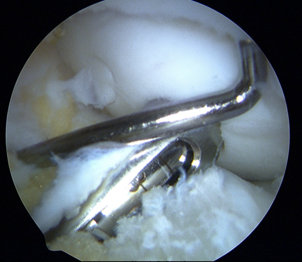 Mosaicplasty 4.5 mm drill 2